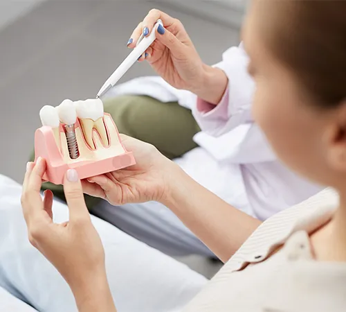 What Are the Signs of Dental Implant Failure