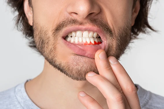 gum disease treatment jacksonville