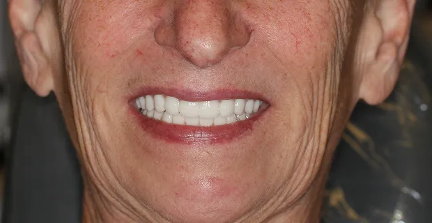 Smile-After-7