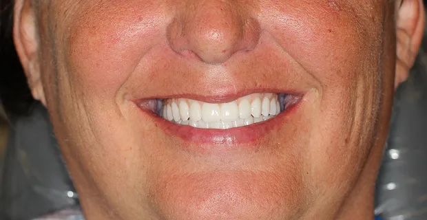 Smile-After-9