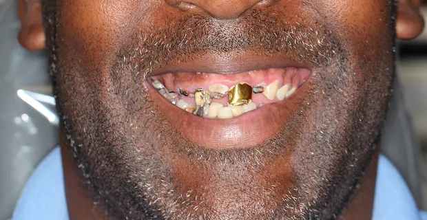 Smile-Before-10