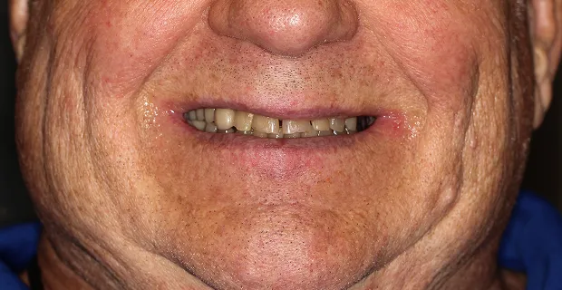 Smile-Before-16