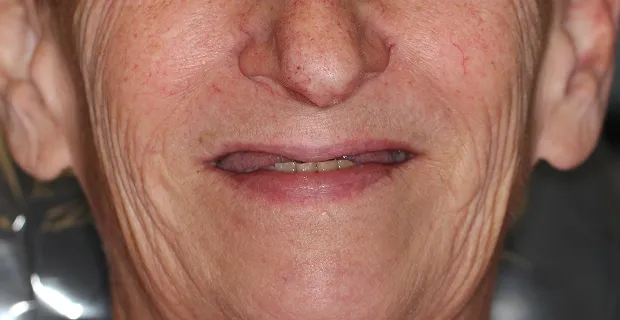 Smile-Before-7