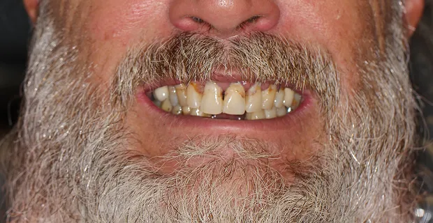 Smile-Before-8