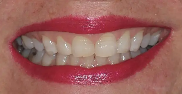 cosmetic11a (1)