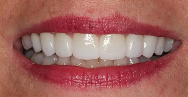 cosmetic11b (1)