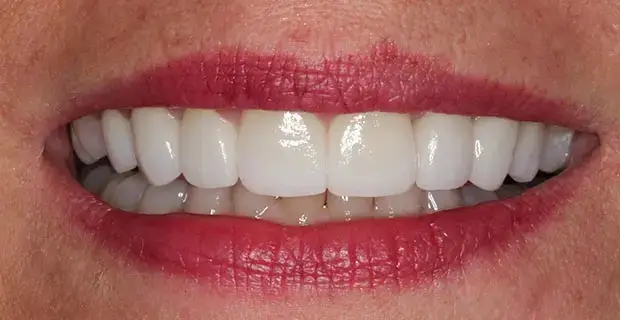 cosmetic11b
