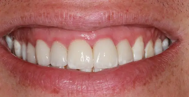 cosmetic12b (1)