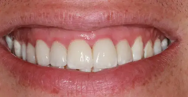 cosmetic12b