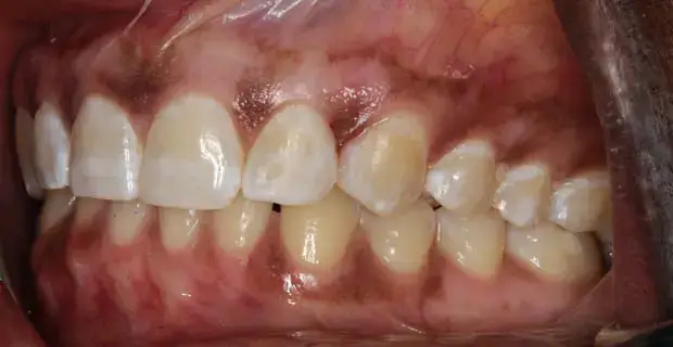 Cosmetic Makeover Before - Patient 1
