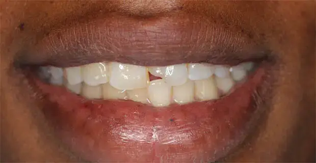 cosmetic5a