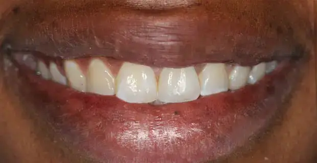 cosmetic5b