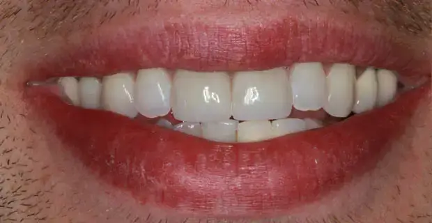 cosmetic7b
