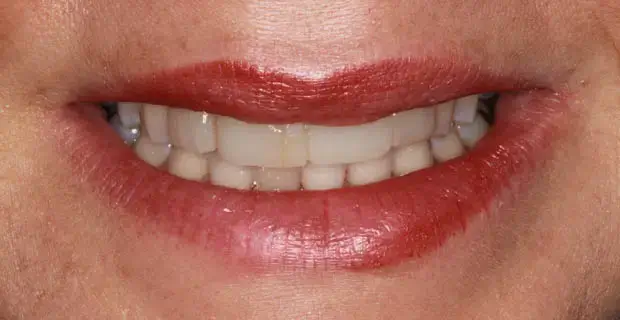 cosmetic9a
