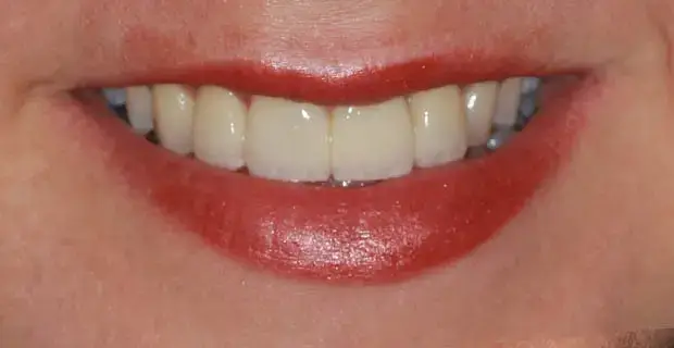 cosmetic9b