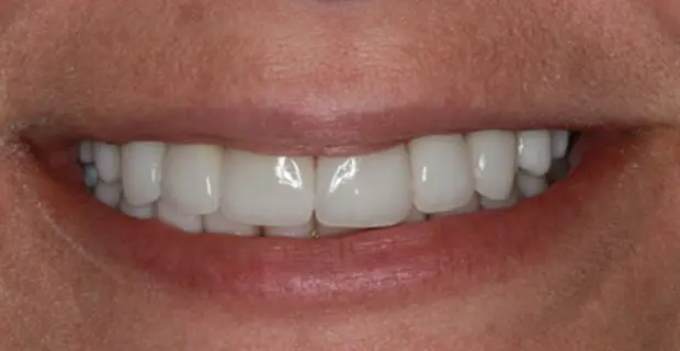 example-after