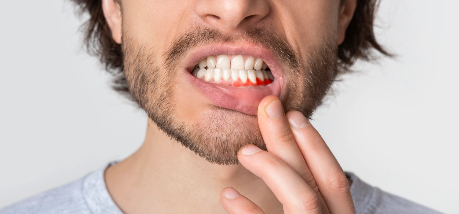 Periodontist in Jacksonville FL